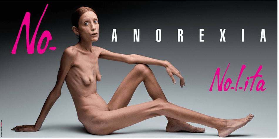 mulher com anorexia